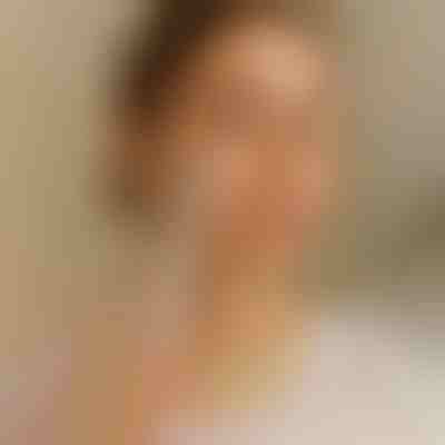 Arcszőrzet eltávolító epilátor | EPISLIK